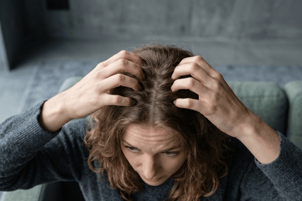 Cuir chevelu qui gratte : que faire pour calmer durablement les démangeaisons ?